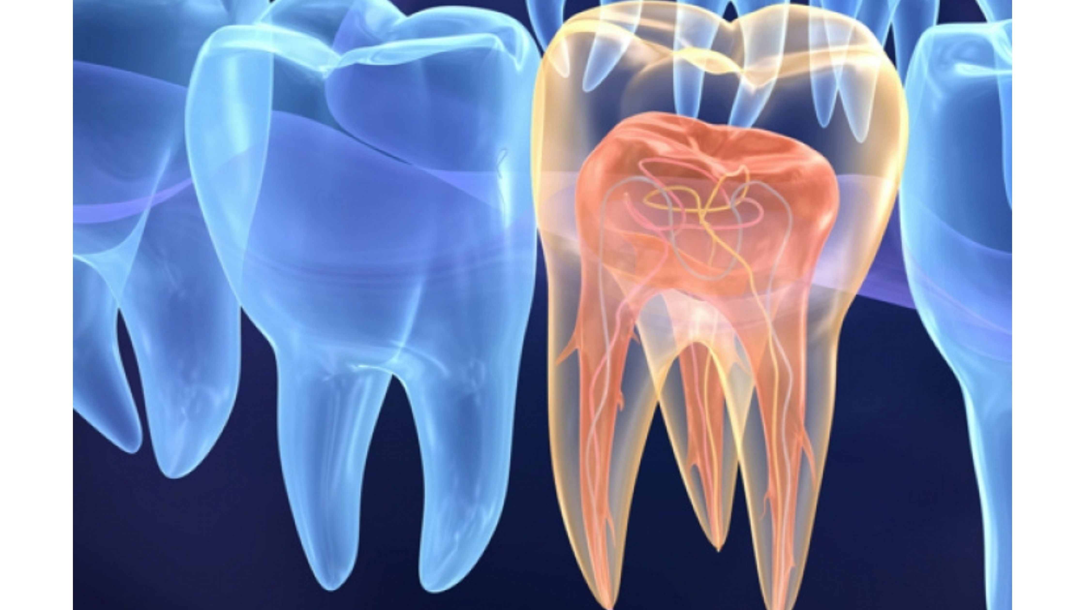 A endodontia tem uma função básica salvar dentes A endodontia tem uma função básica salvar dentes